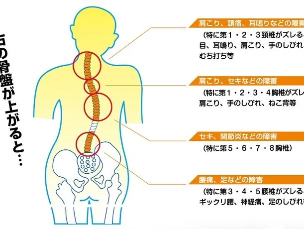 カイロプラクティック体験会 7月